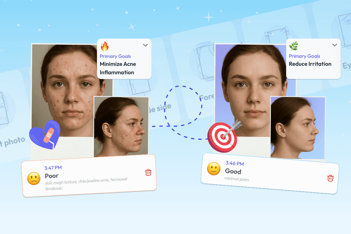 The Skin Bliss AI Progress Tracker showing a comparison between a current skin photo and the original Face Scan baseline